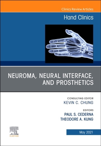 Neuroma, Neural interface, and Prosthetics, An Issue of Hand Clinics