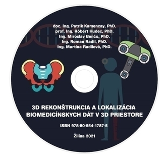 CD - 3D rekonštrukcia a lokalizácia biomedicínskych dát v 3D priestore