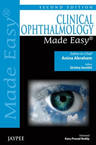 Clinical Ophthalmology Made Easy
