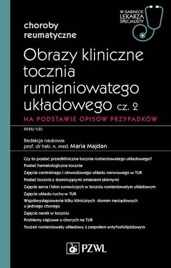 Obrazy kliniczne tocznia rumieniowatego układowego Część 2