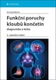 Funkční poruchy kloubů končetin