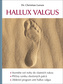 Hallux valgus