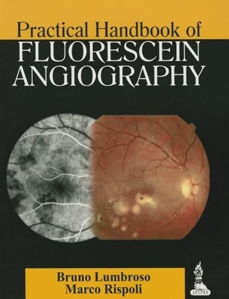 Practical Handbook of Fluorescein Angiography