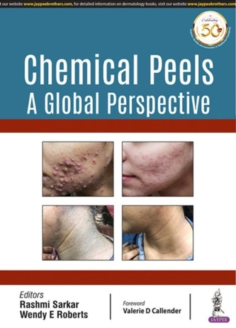 Chemical Peels: A Global Perspective
