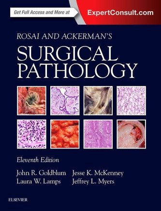 Rosai and Ackerman´s Surgical Pathology - 2 Volume Set
