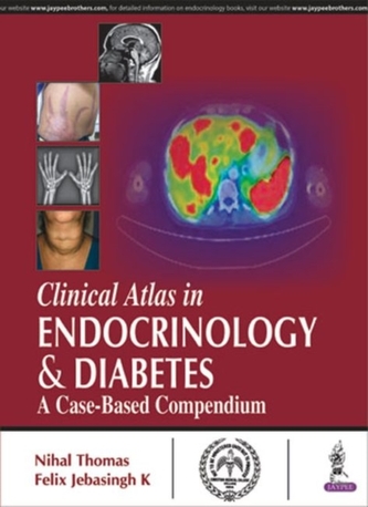 Clinical Atlas in Endocrinology & Diabetes