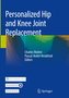 Personalized Hip and Knee Joint Replacement