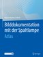 Bilddokumentation mit der Spaltlampe