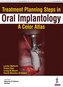 Treatment Planning Steps in Oral Implantology