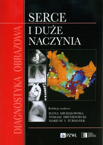 Diagnostyka obrazowa Serce i duże naczynia