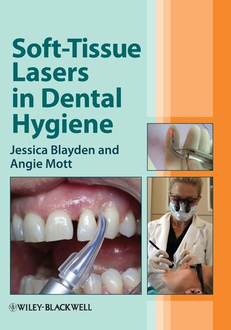 Soft-Tissue Lasers in Dental H