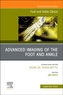 Advanced Imaging of the Foot and Ankle, An issue of Foot and Ankle Clinics of North America