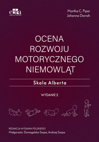 Ocena rozwoju motorycznego niemowląt. Skala Alberta Ocena rozwoju motorycznego niemowląt. Skala Alberta