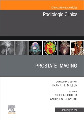 Prostate Imaging, An Issue of Radiologic Clinics of North America