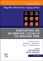 Demyelinating and Inflammatory Lesions of the Brain and Spine, An Issue of Magnetic Resonance Imaging Clinics of North A