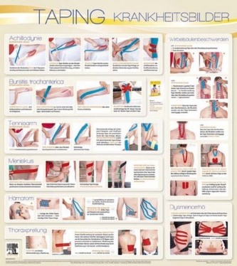 Taping Wandtafel Krankheitsbilder