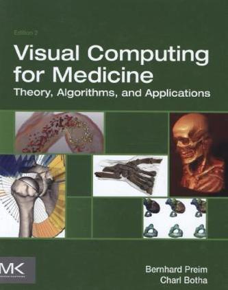 Visual Computing for Medicine