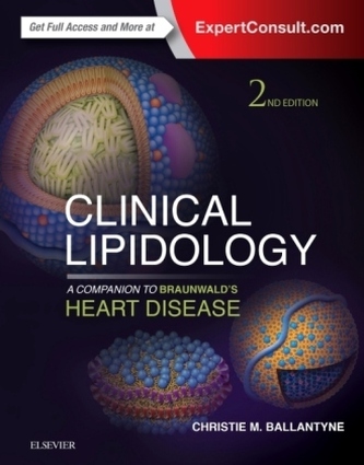 Clinical Lipidology