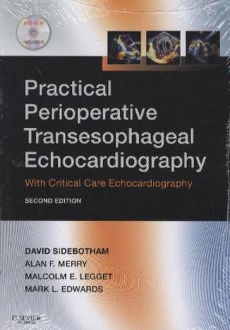 Practical Perioperative Transesophageal Echocardiography, w. DVD-ROM