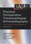 Practical Perioperative Transesophageal Echocardiography, w. DVD-ROM