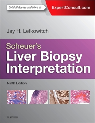 Scheuer's Liver Biopsy Interpretation