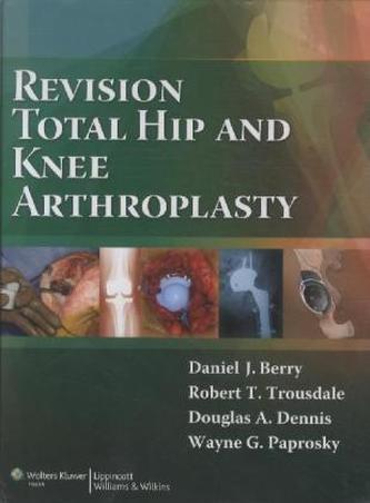 Revision Total Hip and Knee Arthroplasty