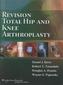 Revision Total Hip and Knee Arthroplasty