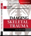 Imaging Skeletal Trauma
