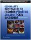 Goodheart's Photoguide to Common Skin Disorders
