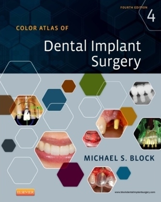 Color Atlas of Dental Implant Surgery