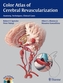 Color Atlas of Cerebral Revascularization, w. DVD