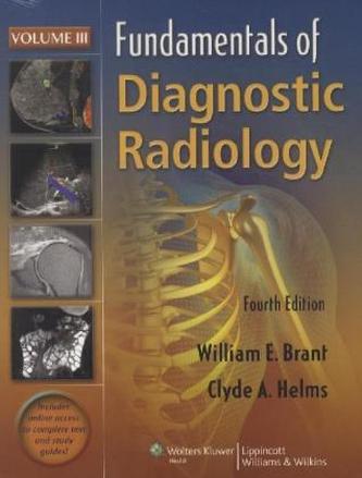 Fundamentals of Diagnostic Radiology, 4 Vols.
