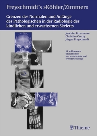 Freyschmidts 'Köhler/Zimmer': Grenzen des Normalen und Anfänge des Pathologischen in der Radiologie des kindlichen und erwachsen