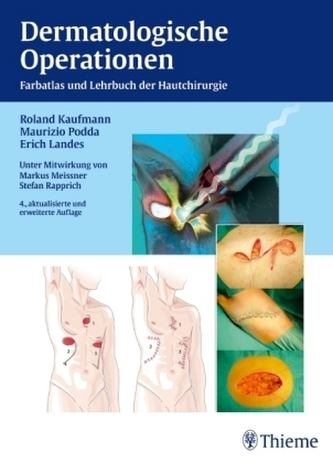 Dermatologische Operationen