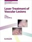 Laser Treatment of Vascular Lesions