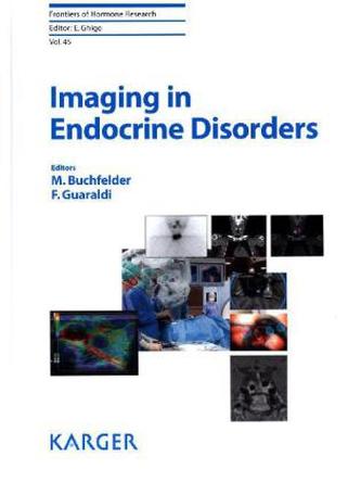 Imaging in Endocrine Disorders