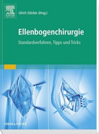 Ellenbogenchirurgie
