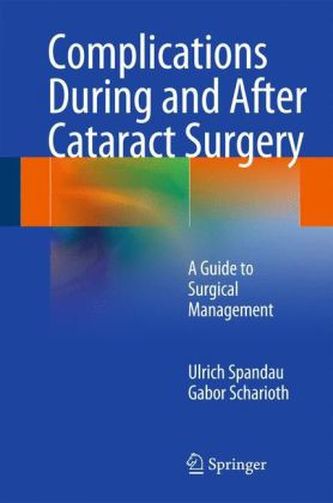 Complications During and After Cataract Surgery, w. DVD