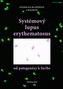 Systémový lupus erythematosus /od patogenézy k liečbe
