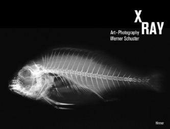 X-Ray