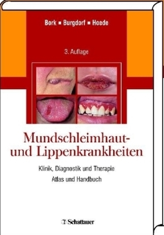 Mundschleimhaut- und Lippenkrankheiten
