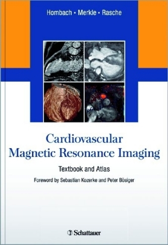Cardiovascular Magnetic Resonance Imaging