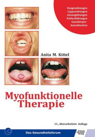 Myofunktionelle Therapie