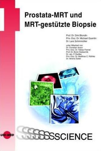 Prostata-MRT und MRT-gestützte Biopsie