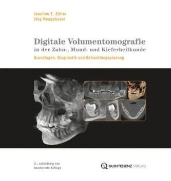 Digitale Volumentomografie in der Zahn-, Mund- und Kieferheilkunde, m. DVD-ROM