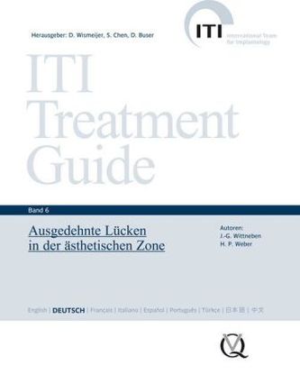 Ausgedehnte Lücken in der ästhetischen Zone