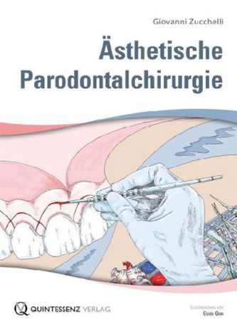 Ästhetische Parodontalchirurgie, Buch + Lehrtafeln