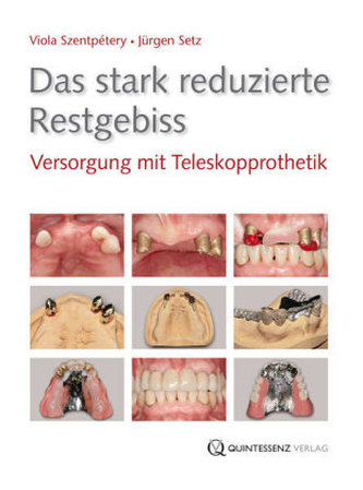 Das stark reduzierte Restgebiss