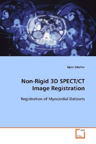 Non-Rigid 3D SPECT/CT Image Registration