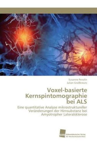 Voxel-basierte Kernspintomographie bei ALS Voxel-basierte Kernspintomographie bei ALS